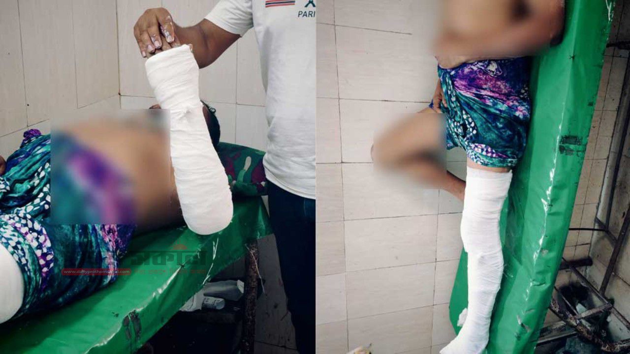 চাঁদা না পেয়ে ব্যবসায়ীর হাত-পা ভাঙল শ্রমিক দল নেতা